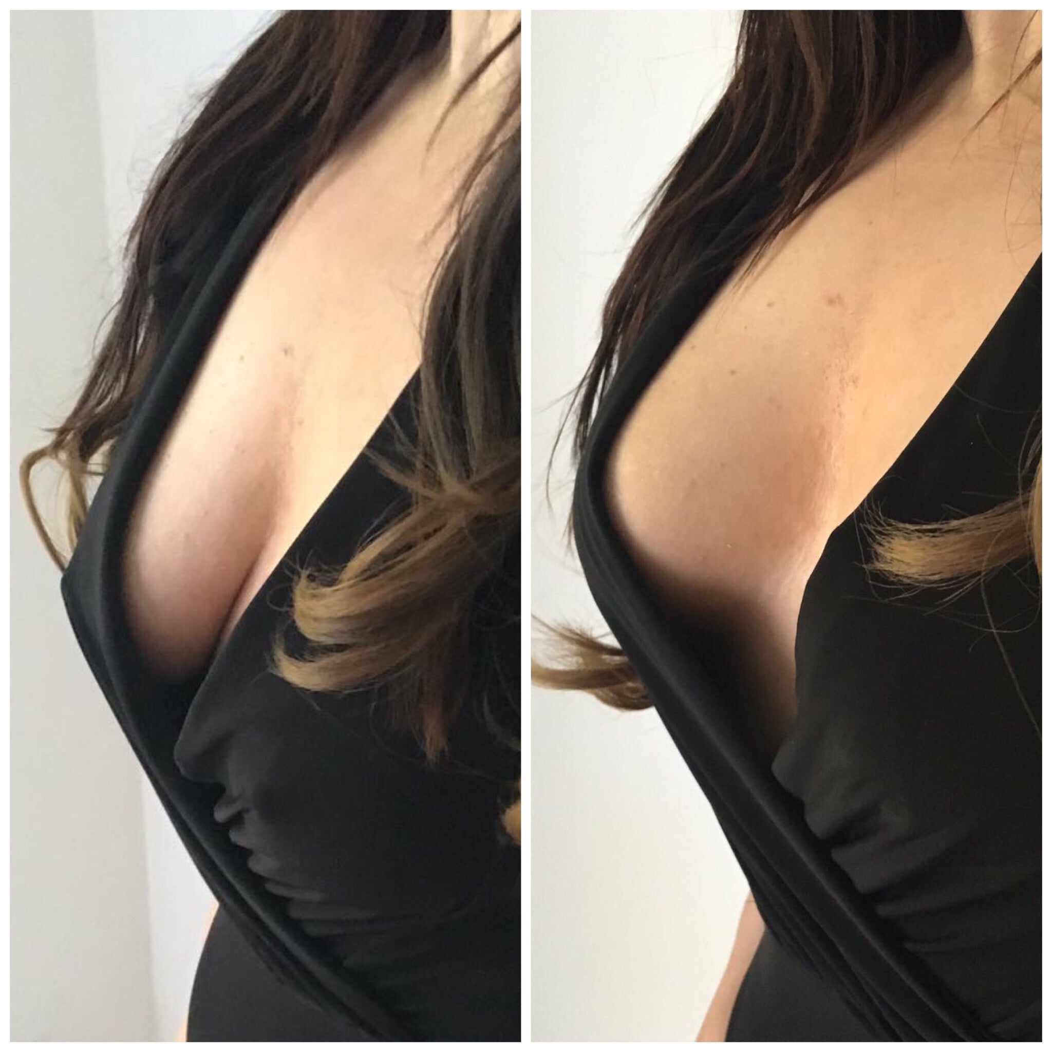 Perky Pear breast lift & shape tape- Why we're the best boob tape!